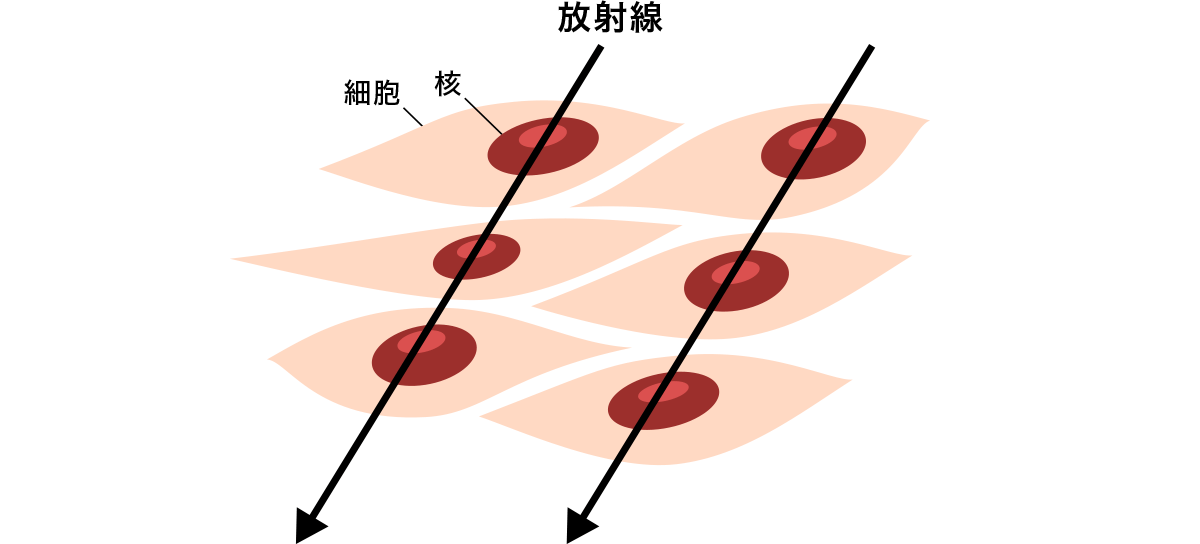 放射線がDNAに傷を付ける